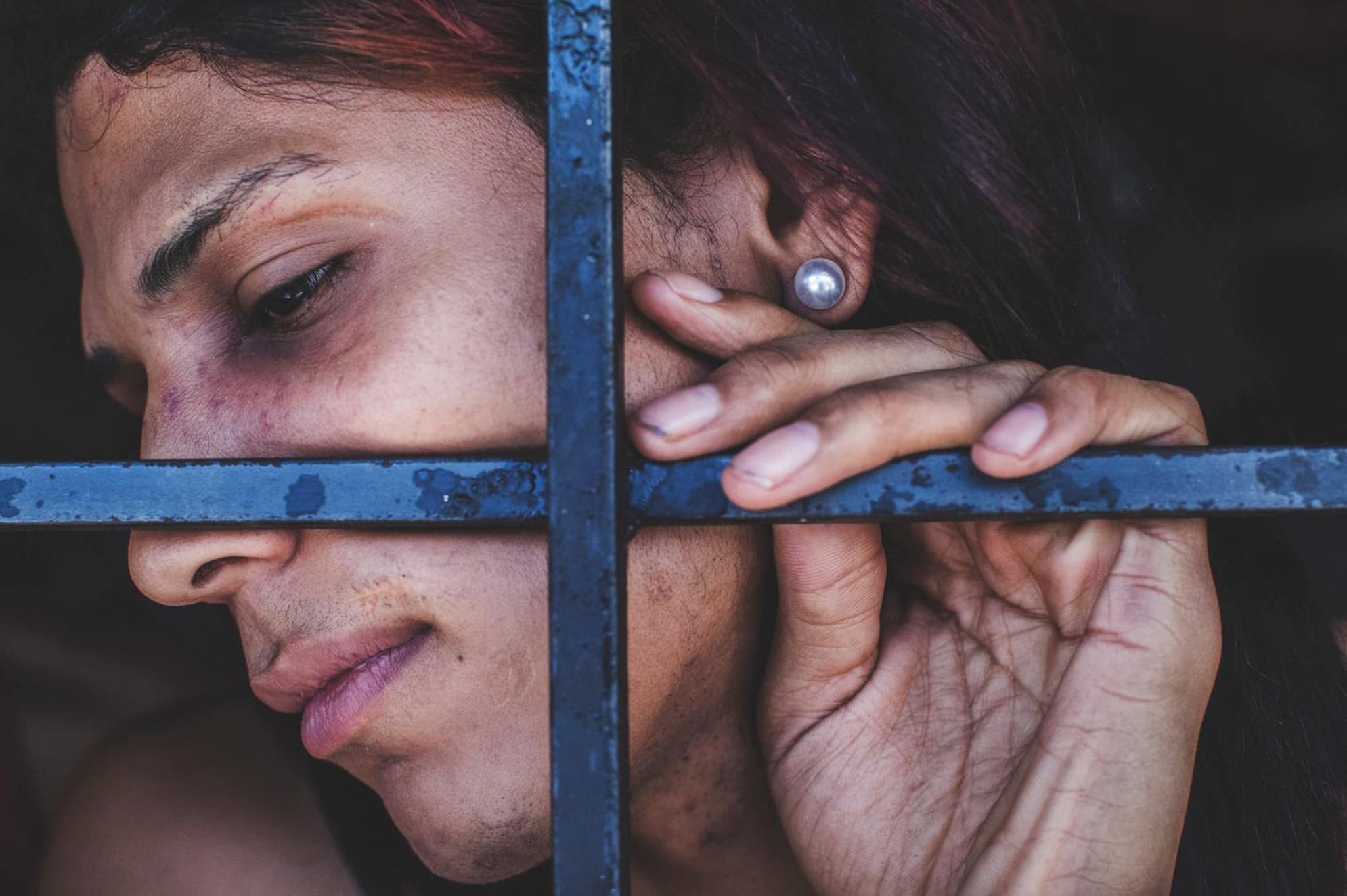 A bruised transgender woman is forced to wait for trial confined with male prisoners, many of whom abuse her. Image by Ana María Arévalo. Venezuela, 2017. A bruised transgender woman is forced to wait for trial confined with male prisoners, many of whom abuse her. Image by Ana María Arévalo. Venezuela, 2017.