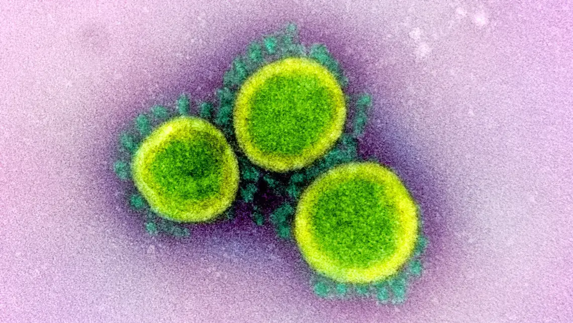 Johnson &amp; Johnson is launching a major push to develop a vaccine that can neutralize the new coronavirus. Image by National Institute of Allergy and Infectious Diseases / National Institutes of Health. United States, 2020.