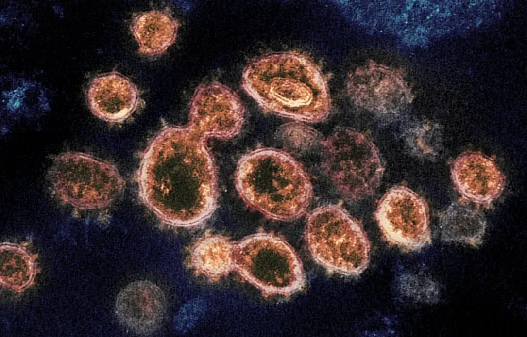 The heartburn remedy famotidine may disable a key enzyme that the new coronavirus uses to make copies (gold) of itself. Image courtesy NIH.