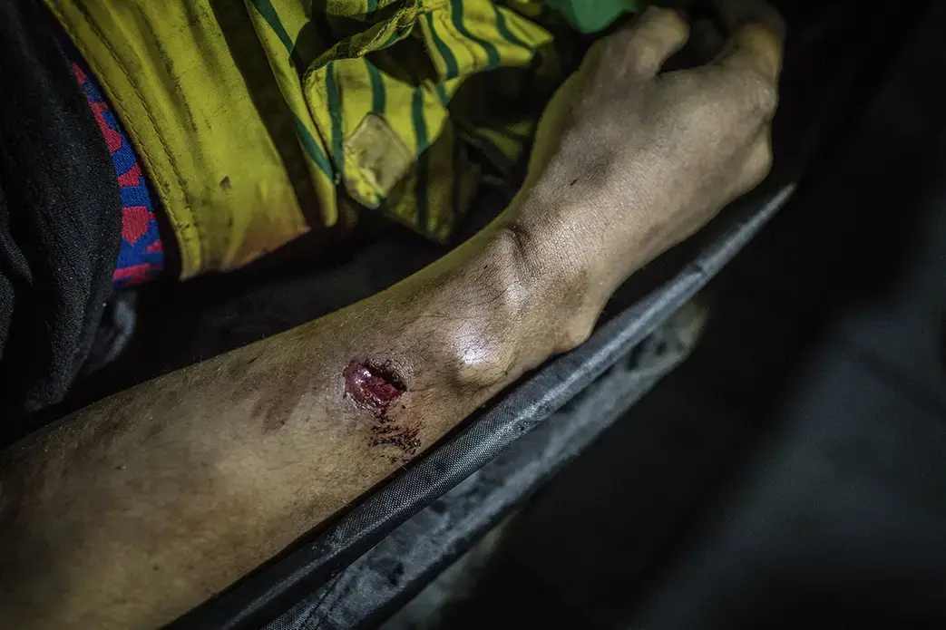 The indentation on the wrist of Julius Soriano, 24-years-old, shows signs that his hands were bound before he was shot to death during a police operation in Caloocan, Metro Manila. There is a bullet wound in his arm too, and the slug is still embedded in his arm, coming to a stop exactly were the indentation line left an impression in his skin, suggesting that whatever caused the indentation stopped the bullet too. Image by James Whitlow Delano. Philippines, 2017.