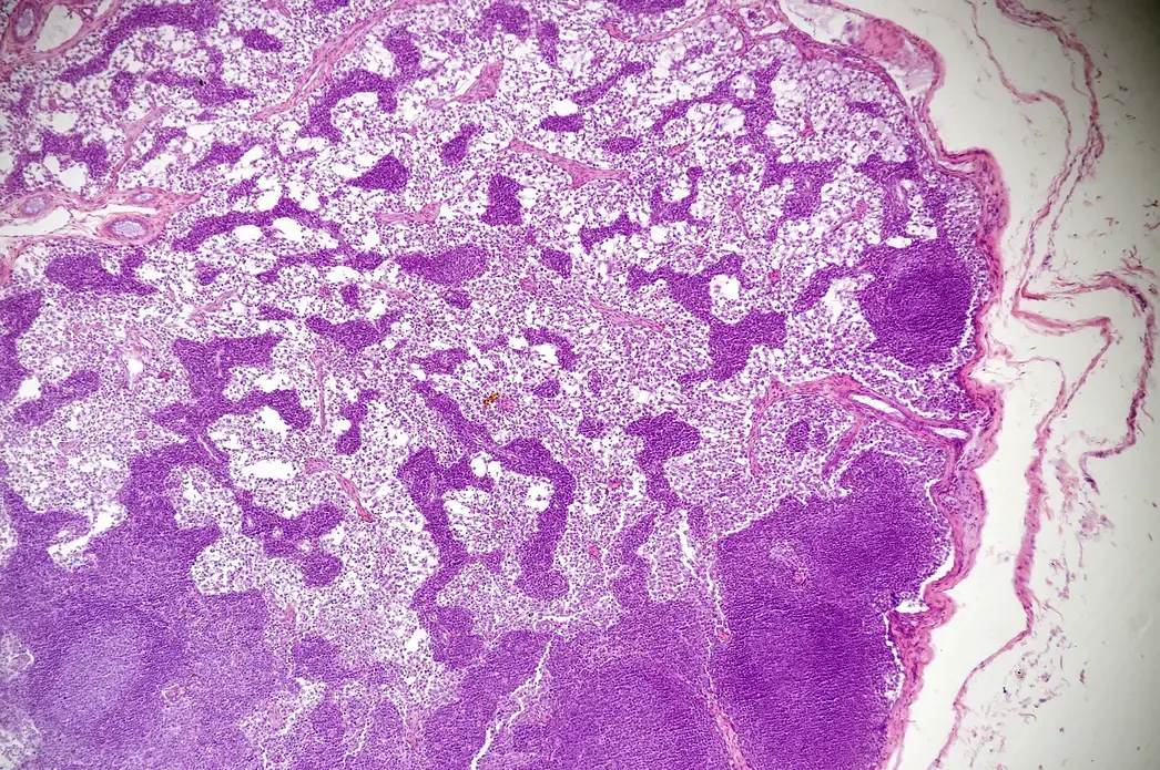 Microscopic view of a lymph node