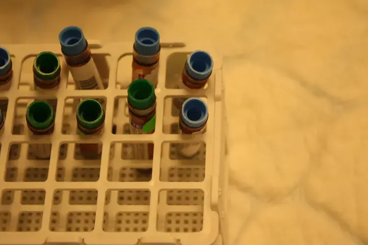 Vials with blood samples in DeCode's Genetics' lab in Reykjavik. Image by Anna M. Clausen. Iceland, 2017.&nbsp;