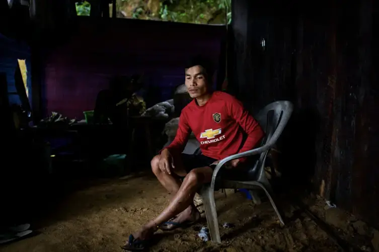 Bo Kyaw Thant, a 21-year-old freelance miner, sits in his house. He survived the July 2 landslide in Gwi Hka mine in Hpakant, Kachin State, Myanmar. Image by Hkun Lat. Myanmar, 2020.