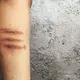 Scars on a female detainee’s legs at La Alcaidesa, Merida, that she said were the result of fights. Many women also injure themselves. Image by Ana María Arévalo. Venezuela, 2018. 